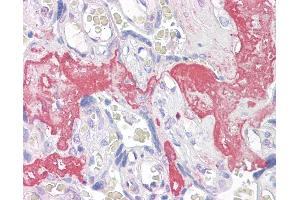 Anti-GAGED2 antibody IHC of human placenta. (XAGE1D Antikörper  (AA 58-69))