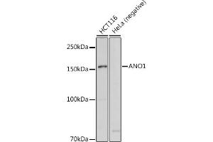Western blot analysis of extracts of various cell lines, using  antibody (ABIN6129706, ABIN6136901, ABIN6136902 and ABIN6214776) at 1:1000 dilution. (ANO1 Antikörper  (AA 628-731))