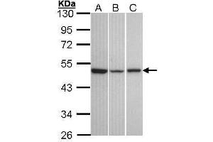 WB Image Sample (30 ug of whole cell lysate) A: A431 , B: Hela C: Hep G2 , 10% SDS PAGE antibody diluted at 1:1000 (KISS1R Antikörper  (C-Term))