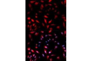 Immunofluorescence analysis of U2OS cell using Phospho-HSPB1-S82 antibody. (HSP27 Antikörper  (pSer82))