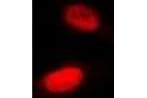 Immunofluorescent analysis of SHARP-2 staining in Hela cells. (BHLHE40 Antikörper)
