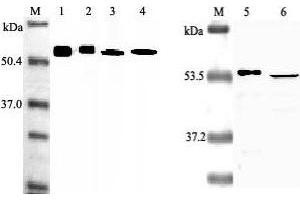 Western blot analysis using anti-Nampt (Visfatin-PBEF), mAb (OMNI379)  at 1:2000 dilution. (NAMPT Antikörper  (Biotin))