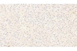 Immunohistochemistry (IHC) image for anti-Wingless-Type MMTV Integration Site Family, Member 11 (WNT11) (AA 204-349) antibody (ABIN7427270)