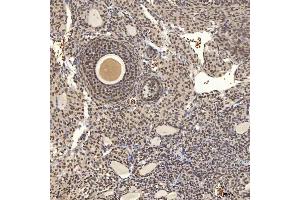 IHC analysis of U1A/SNRPA using anti-U1A/SNRPA antibody (ABIN7600891). (SNRPA1 Antikörper  (AA 25-218))