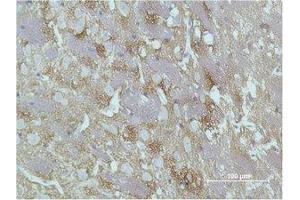 Immunohistochemistry (IHC) analysis of paraffin-embedded Rat Brain Tissue using GAP-43 Monoclonal Antibody.