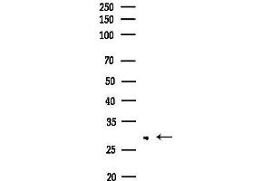 Western blot analysis of lysates from EC304 cells, using  Antibody at 1/1000 dilution.