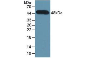 Western blot analysis of recombinant Human CFH. (Complement Factor H Antikörper  (AA 860-1231))