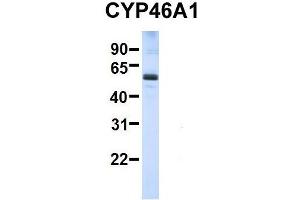 Host:  Rabbit  Target Name:  SERPINA3  Sample Type:  Human Adult Placenta  Antibody Dilution:  1. (CYP46A1 Antikörper  (C-Term))
