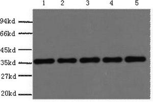 Western Blotting (WB) image for anti-Glyceraldehyde-3-Phosphate Dehydrogenase (GAPDH) antibody (ABIN5959504) (GAPDH Antikörper)