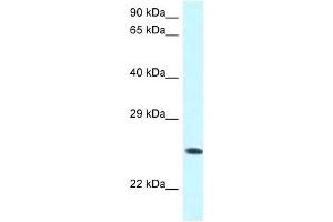 Western Blot showing WWOX antibody used at a concentration of 1 ug/ml against COLO205 Cell Lysate