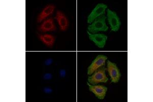 ABIN6260505 and ABIN6279264 staining Hela cells by IF/ICC. (CATSPER3 Antikörper  (Internal Region))