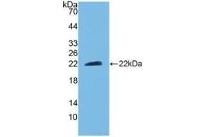 Detection of Recombinant CNTF, Mouse using Polyclonal Antibody to Ciliary Neurotrophic Factor (CNTF) (CNTF Antikörper  (AA 2-198))