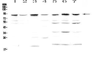 Western blot analysis of BAP1 using anti-BAP1 antibody . (BAP1 Antikörper  (AA 1-278))