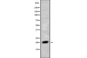 Western blot analysis of RNF5 using Jurkat whole cell lysates (RNF5 Antikörper  (C-Term))