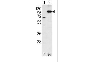 Western blot analysis of P (arrow) using rabbit polyclonal P Antibody (C-term) 6306b. (APP Antikörper  (C-Term))