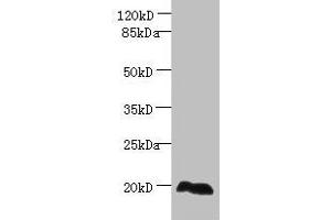 Western blot All lanes: EEF1E1 antibody at 2 μg/mL + HepG2 whole cell lysate Secondary Goat polyclonal to rabbit IgG at 1/10000 dilution Predicted band size: 20, 16 kDa Observed band size: 20 kDa