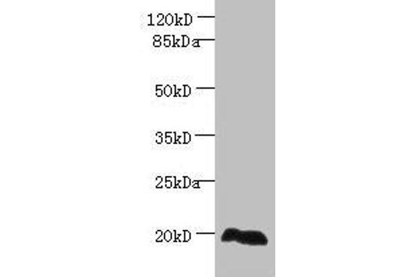 EEF1E1 Antikörper  (AA 2-174)
