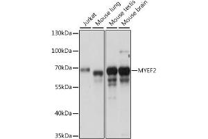 Western blot analysis of extracts of various cell lines, using MYEF2 antibody (ABIN7268721) at 1:1000 dilution. (MYEF2 Antikörper  (AA 1-120))