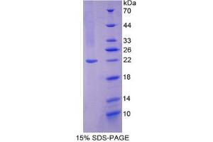SDS-PAGE analysis of Human NOS2 Protein.