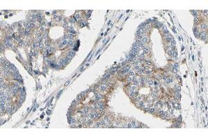 ABIN6276606 at 1/100 staining Human prostate tissue by IHC-P. (TPM3 Antikörper  (N-Term))