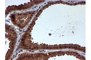 Immunohistochemical staining of paraffin-embedded Human breast tissue using anti-HARS2 mouse monoclonal antibody.
