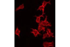 ABIN6272367 staining COLO205 by IF/ICC. (NRIP3 Antikörper  (C-Term))