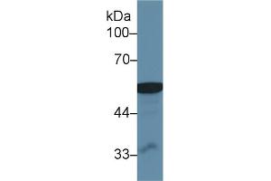 Western Blot; Sample: Human Liver lysate; Primary Ab: 1µg/ml Rabbit Anti-Human ALDM Antibody Second Ab: 0. (ALDH2 Antikörper  (AA 59-150))