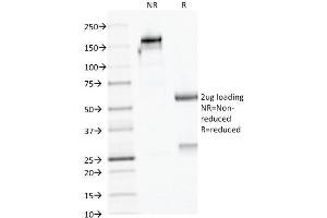 SDS-PAGE Analysis Purified AMACR / p504S Mouse Monoclonal Antibody (AMACR/1723). (AMACR Antikörper)
