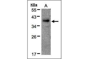 Sample(30 g of whole cell lysate). (RAD51AP1 Antikörper)