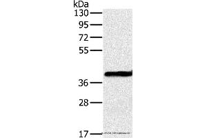 Western blot analysis of Mouse liver tissue, using OTC Polyclonal Antibody at dilution of 1:650 (OTC Antikörper)
