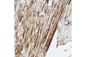 Immunohistochemistry of paraffin-embedded mouse heart using PLOD3 Rabbit pAb (ABIN6130652, ABIN6145791, ABIN6145792 and ABIN6214834) at dilution of 1:50 (40x lens). (PLOD3 Antikörper  (AA 25-280))