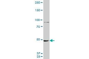 MTA1 monoclonal antibody (M10A), clone 1C3. (MTA1 Antikörper  (AA 601-700))