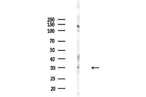 anti-Cathepsin E (CTSE) (Internal Region) antibody