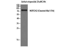 Western Blotting (WB) image for anti-Notch 2 (NOTCH2) (Cleaved-Ala1734), (Internal Region) antibody (ABIN3181820)