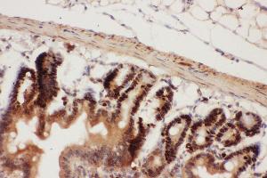 Immunohistochemistry (IHC) image for anti-Beclin 1, Autophagy Related (BECN1) (AA 1-354) antibody (ABIN3042322)
