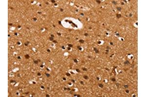 The image on the left is immunohistochemistry of paraffin-embedded Human brain tissue using ABIN7190032(CABLES2 Antibody) at dilution 1/25, on the right is treated with synthetic peptide. (CABLES2 Antikörper)