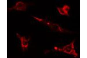 ABIN6274588 staining Hela cells by IF/ICC. (beta Arrestin 1 Antikörper  (C-Term))