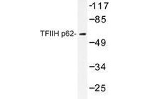 Western blot analysis of TFIIH p62 antibody in extracts from Jurkat cells. (GTF2H1 Antikörper)