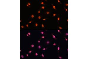 Immunofluorescence (IF) image for anti-Chromodomain Helicase DNA Binding Protein 4 (CHD4) (AA 1520-1690) antibody (ABIN6138512)