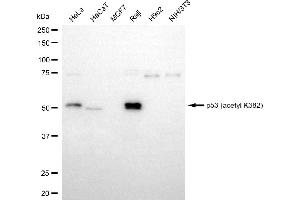 Western blotting analysis using p53 (acetyl K382) antibody (ABIN7800683).
