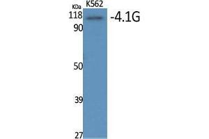 Western Blot (WB) analysis of specific cells using 4. (EPB41L2 Antikörper  (Internal Region))