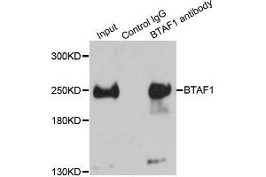 Immunoprecipitation analysis of 150ug extracts of HeLa cells using 3ug BTAF1 antibody.