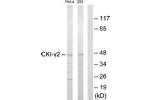 Western blot analysis of extracts from HeLa/293 cells, using CKI-gamma2 Antibody. (Casein Kinase 1 gamma 2 Antikörper  (AA 10-59))
