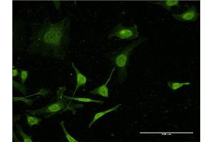 Immunofluorescence of monoclonal antibody to C4B on HeLa cell. (C4B Antikörper  (AA 1347-1446))