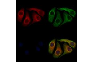 ABIN7094032 and ABIN7098076 staining Hela cells by IF/ICC.