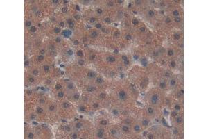 Immunohistochemistry (IHC) image for anti-ADAM Metallopeptidase with Thrombospondin Type 1 Motif, 13 (ADAMTS13) (AA 896-1131) antibody (ABIN7432937)