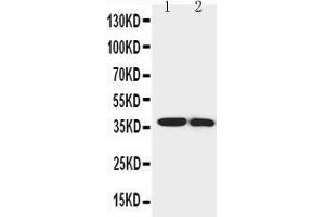 Anti-IGFBP1 antibody, Western blotting Lane 1: SMMC Cell Lysate Lane 2: MCF-7 Cell Lysate (IGFBPI Antikörper  (Middle Region))
