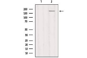 Western blot analysis of extracts from Hela, using MYH3 Antibody. (MYH3 Antikörper  (C-Term))