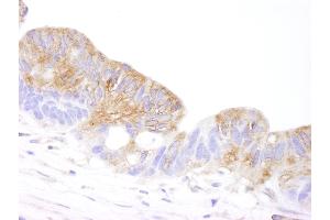 anti-Coronin, Actin Binding Protein, 1B (CORO1B) (AA 400-450) antibody