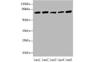 Western blot All lanes: Hspa1b antibody at 5 μg/mL Lane 1: A431 whole cell lysate Lane 2: A549 whole cell lysate Lane 3: Jurkat whole cell lysate Lane 4: MCF-7 whole cell lysate Lane 5: K562 whole cell lysate Secondary Goat polyclonal to rabbit IgG at 1/10000 dilution Predicted band size: 71 kDa Observed band size: 71 kDa (HSPA1B Antikörper  (AA 2-642))
